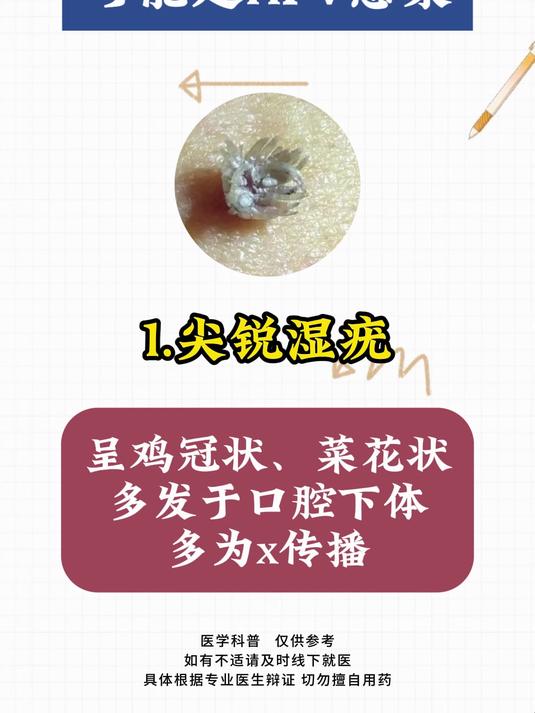 情侣身上这几种疣体 可能是HPV感染