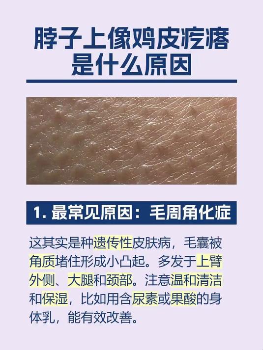 脖子上像鸡皮疙瘩是什么原因