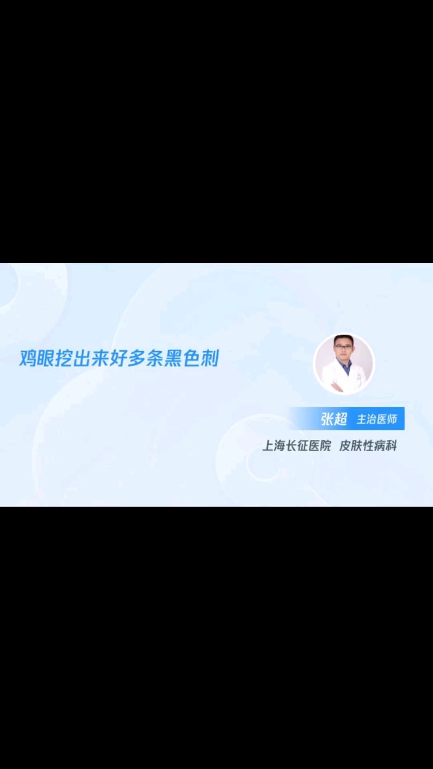 鸡眼挖出来好多黑色刺怎么回事?