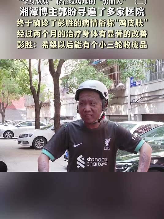 “全身恶臭”躲在垃圾堆的“黑面人”