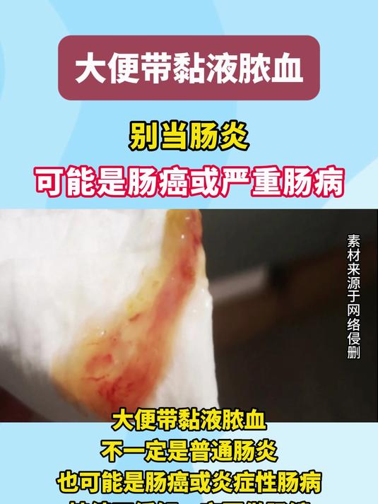 大便带黏液脓血？别当肠炎！可能是肠癌或严重肠病#健康向阳计划#