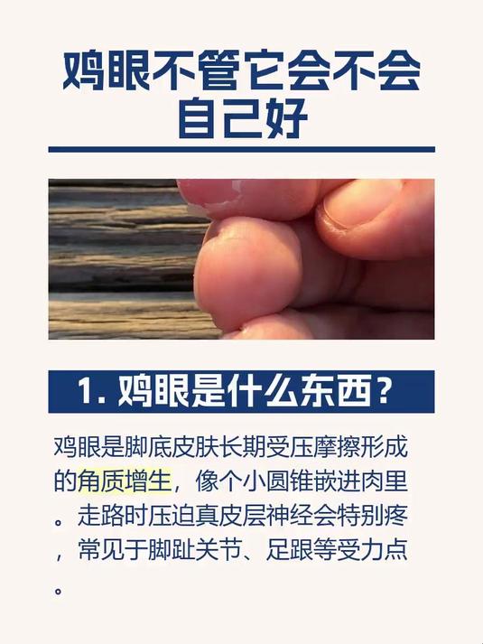 鸡眼不管它会不会自己好