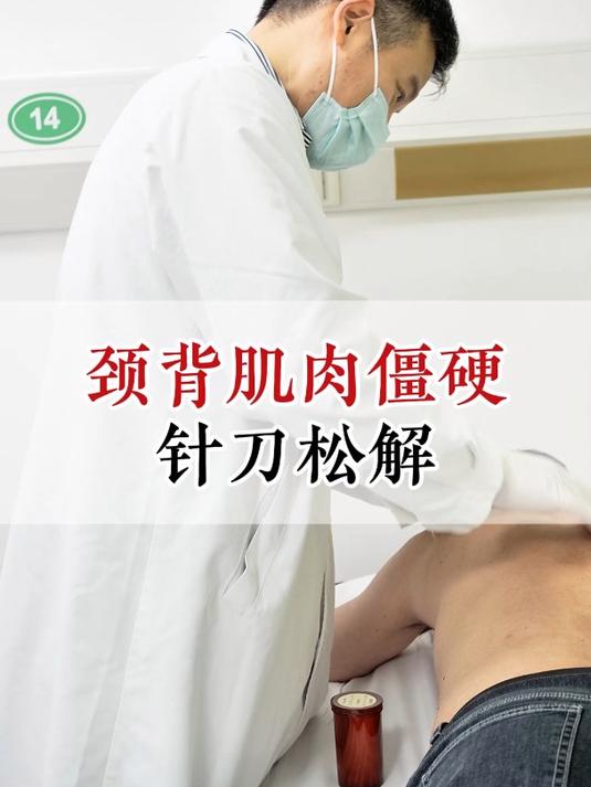 颈背肌肉僵硬,针刀松解