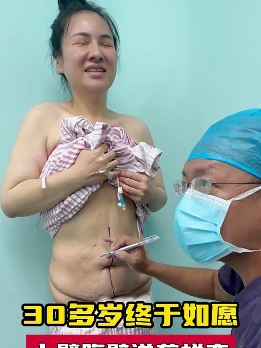 大体重减肥后一身皮,胳膊拜拜肉多年心病,夏扬:一起直接解决!