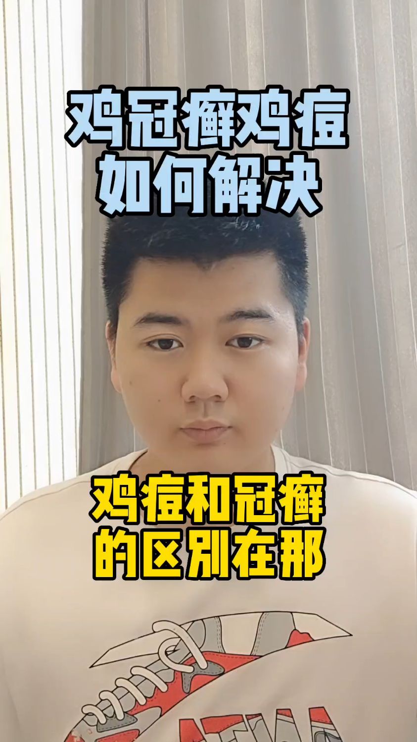 #鸡冠癣和鸡痘区别鸡痘和鸡冠癣怎么区分鸡上长了个小疙瘩怎么回事鸡痘是什么样子的