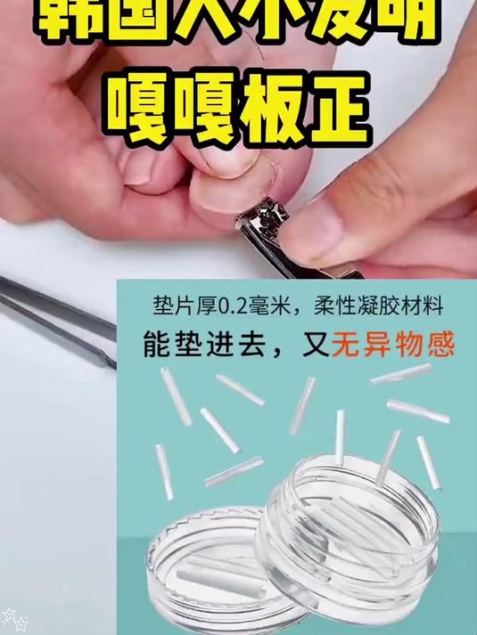 指甲总往肉里钻？嵌甲分离片解救，告别疼痛超轻松！