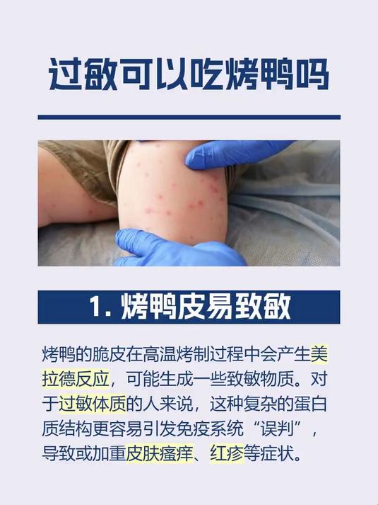 过敏可以吃烤鸭吗