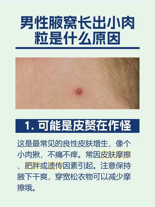 男性腋窝长出小肉粒是什么原因