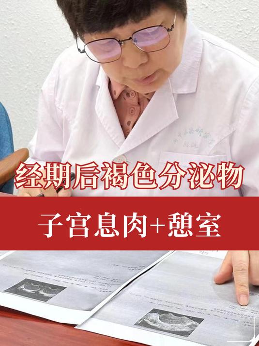 经期后,褐色分泌物,和子宫憩室以及子宫内膜息肉有关