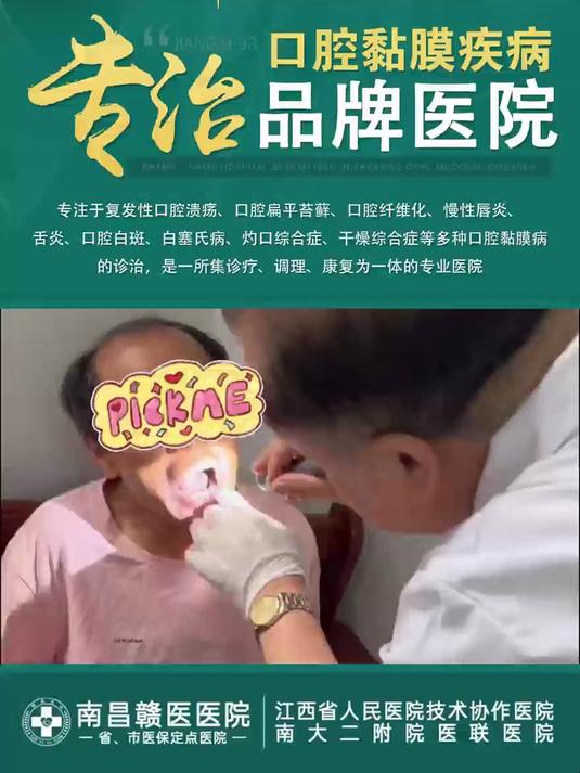南昌赣医医院口腔黏膜科梁必孝：患者舌边缘长出肉疙瘩，伴糜烂疼