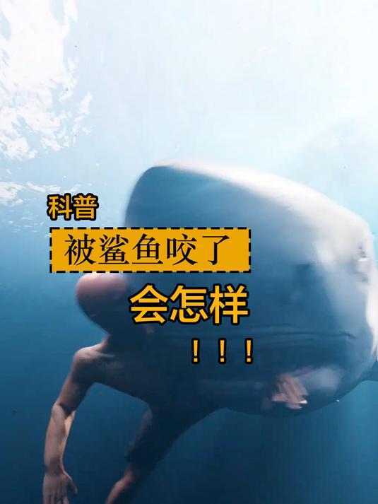 当你小子被鲨鱼咬了,那么该怎么办呢?我们一起来看下就明白了!