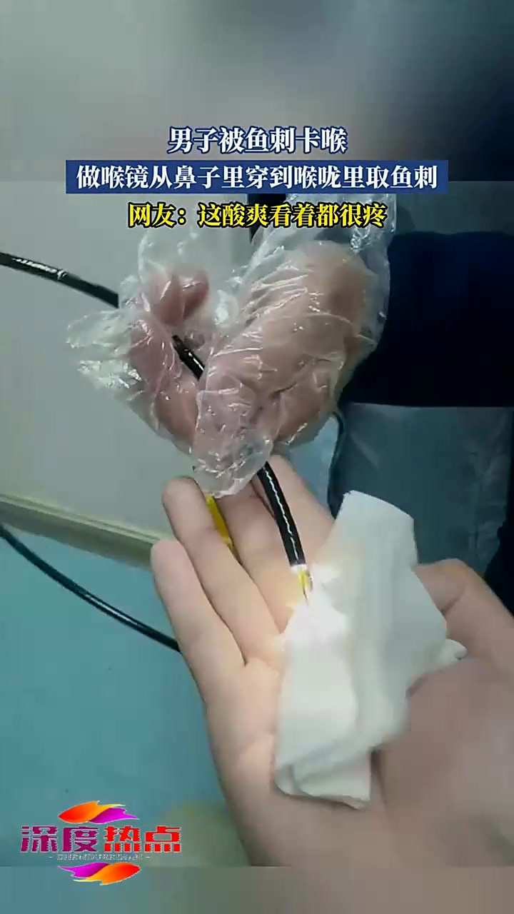 男子被鱼刺卡喉,做喉镜从鼻子里穿到喉咙里取鱼刺,网友:这酸爽