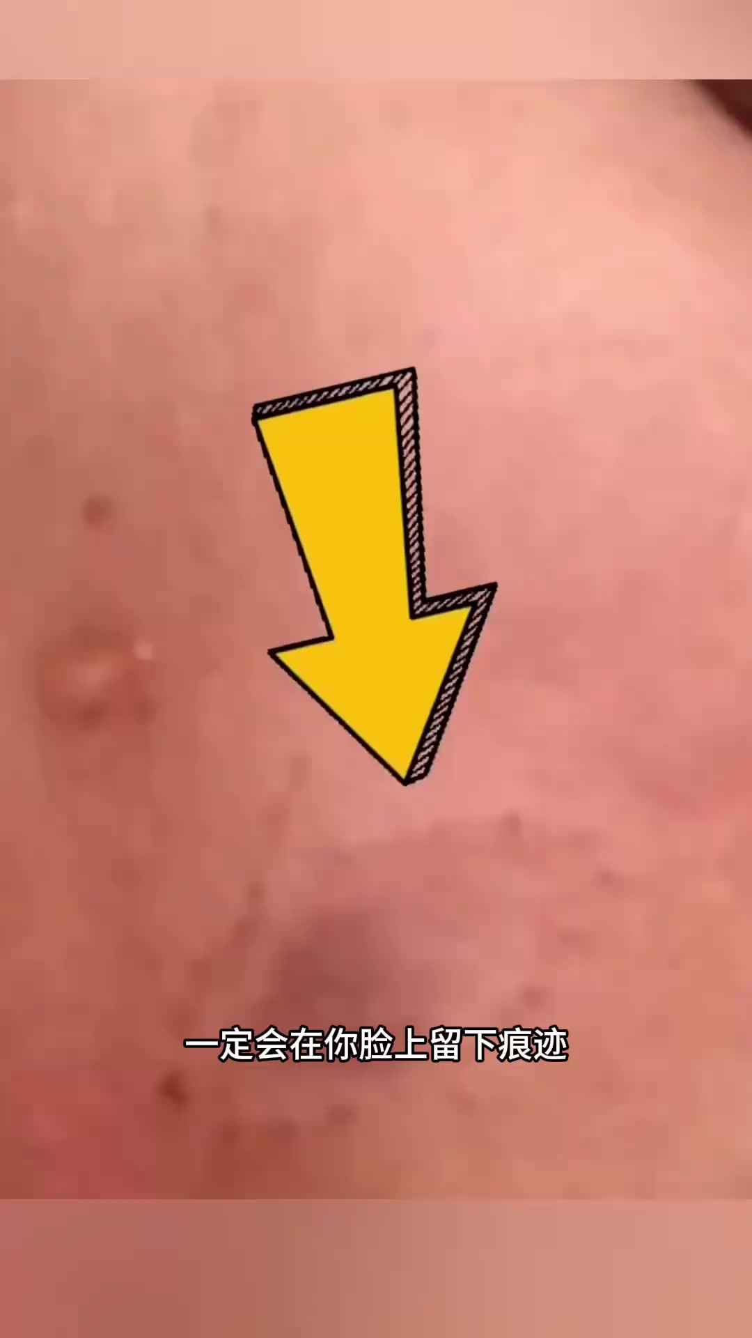 “斑机鱼:嘴唇性感、攻击性强,潜水者的海底噩梦”