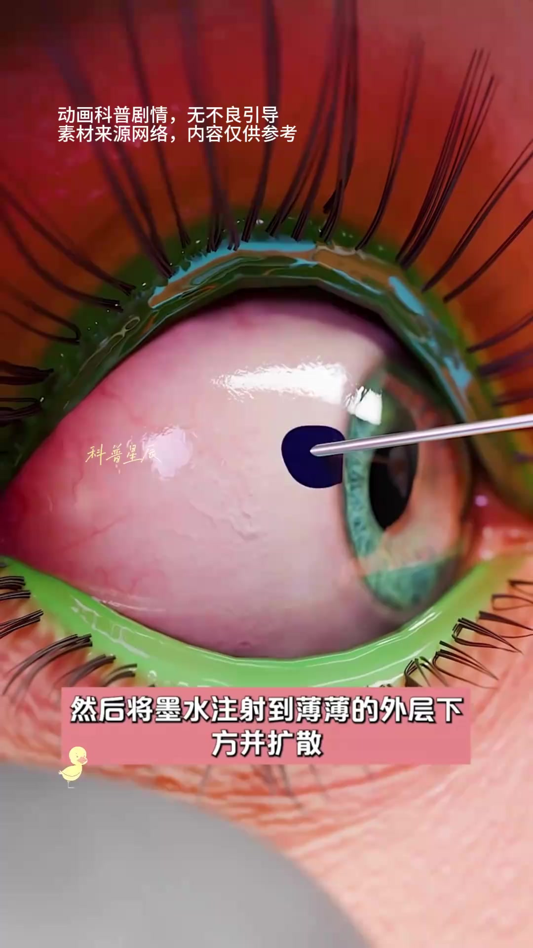 警惕眼睛纹身风险与球鱼求生策略的奇妙联系
