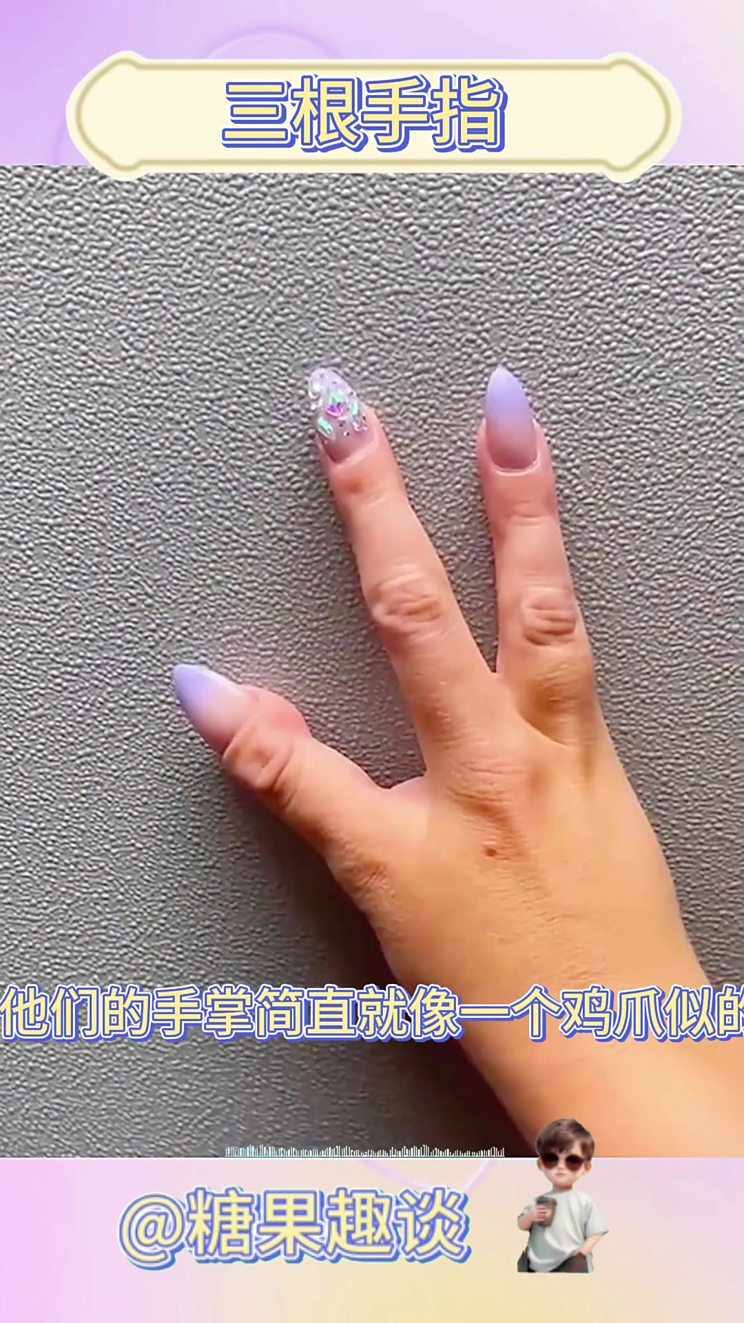 奇人异事:世界惊现三指人,手掌如鸡爪,脚印似恐龙前爪