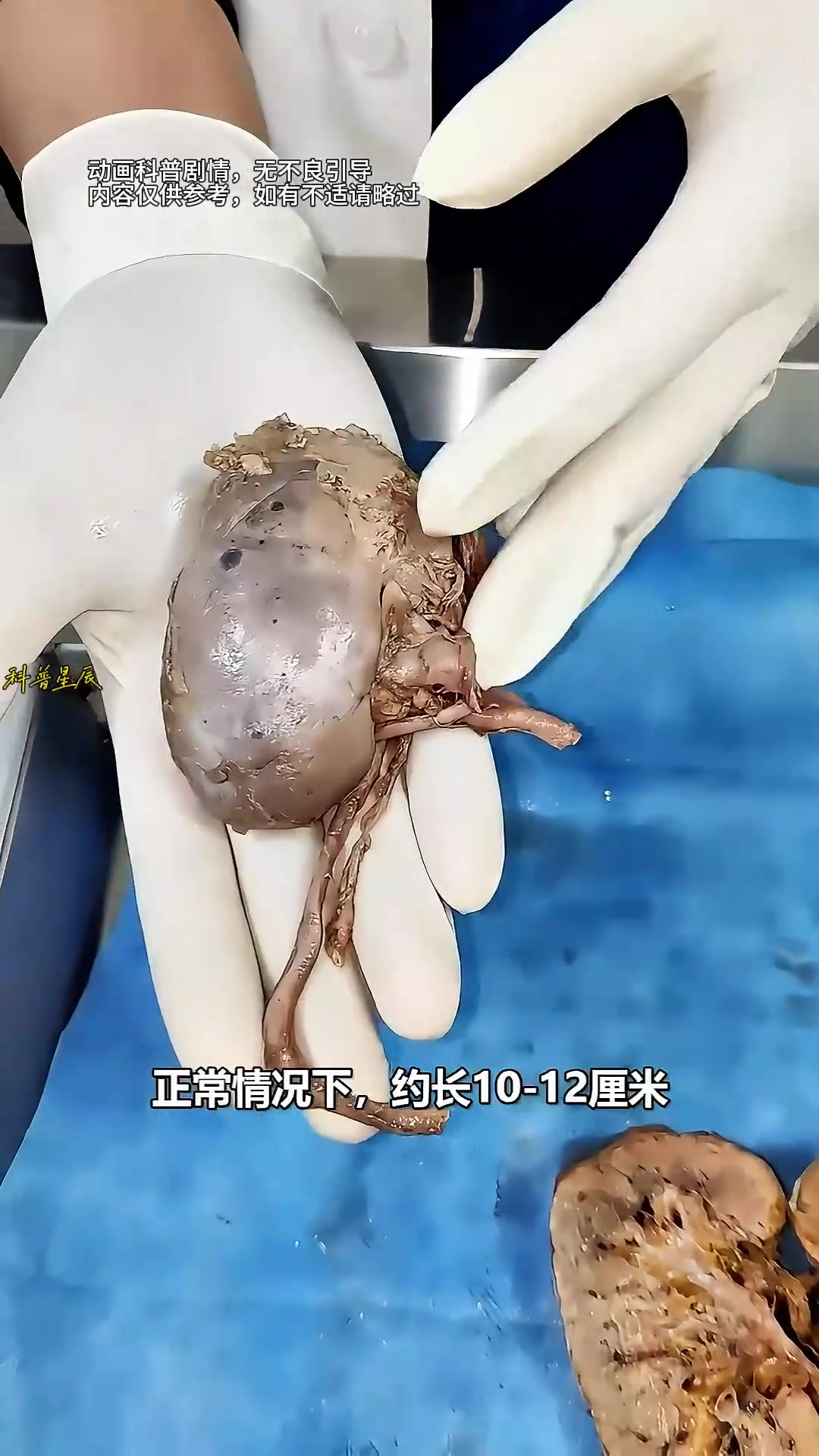 肾脏结构揭秘:位置、功能与重要组成部分详解