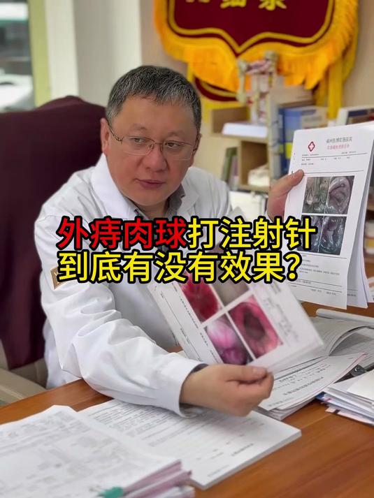 外痔肉球打注射针到底有没有效果？