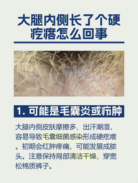 大腿内侧长了个硬疙瘩怎么回事
