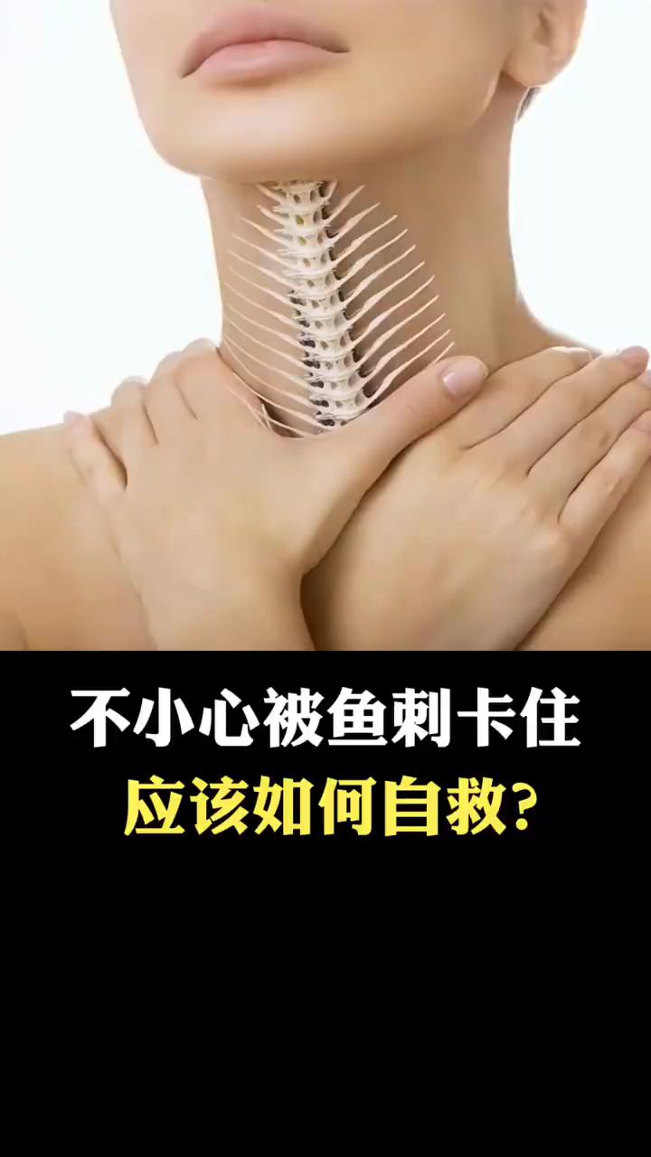 不小心被鱼刺卡住,应该怎么办?
