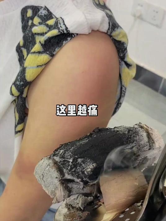 专业级家用悬灸器具!360°旋转灸头设计,自己在家做养生馆级艾灸