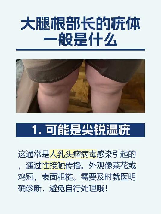 #马上健康过大年#大腿根部长的疣体一般是什么