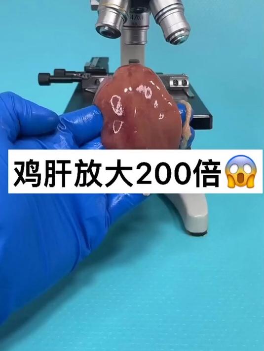 鸡肝真的卫生吗……
