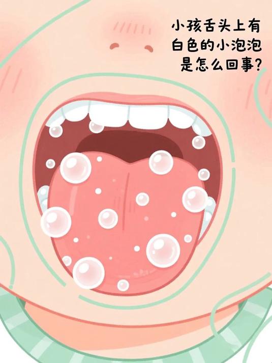 小孩舌头上有白色的小泡泡是怎么回事 #健康扬帆季#