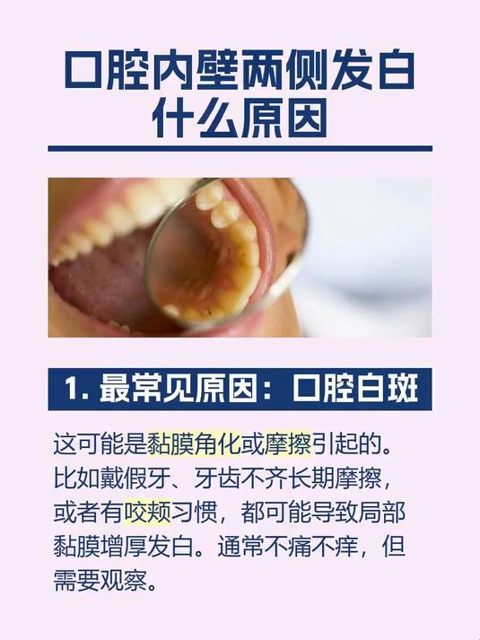 #马上健康过大年#口腔内壁两侧发白什么原因