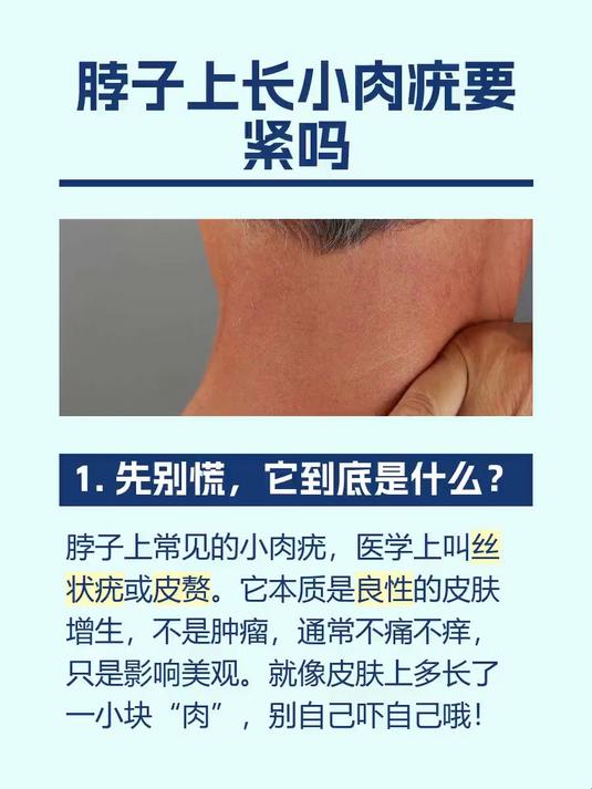 脖子上长小肉疣要紧吗