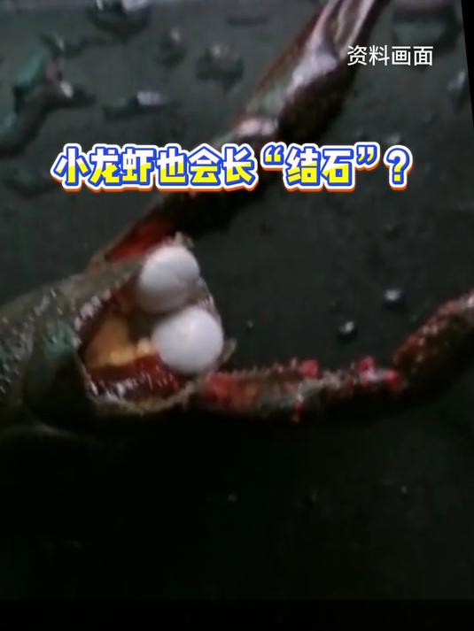 小龙虾也会长“结石”?