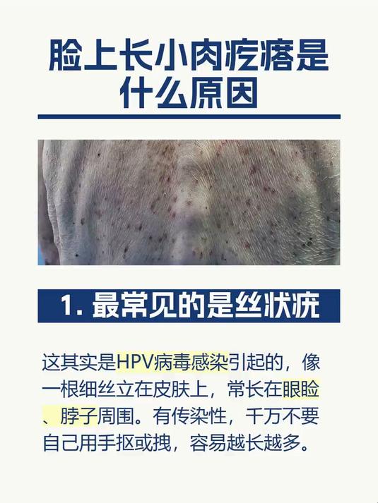 脸上长小肉疙瘩是什么原因
