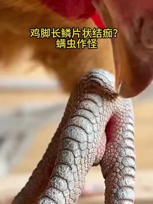 鸡脚长鳞片状结痂?螨虫作怪