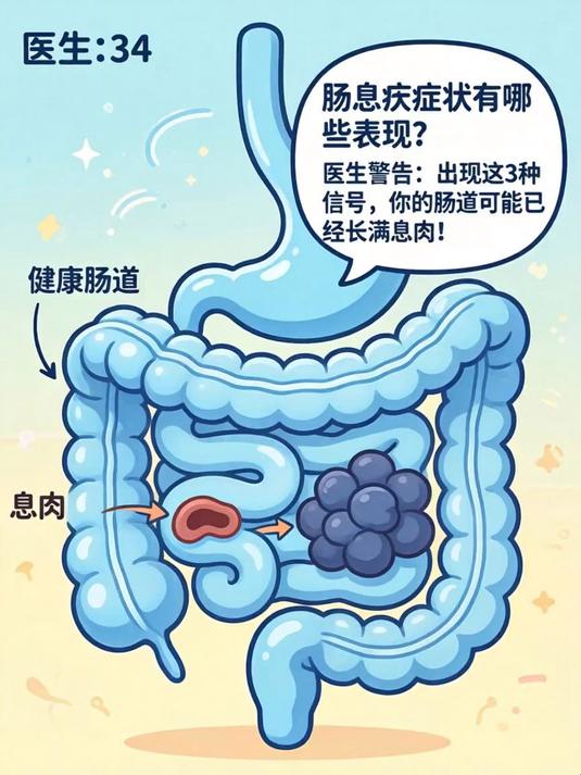 肠息肉症状有哪些表现？医生警告：出现这3种信号，你的肠道可能已经长满息肉！
