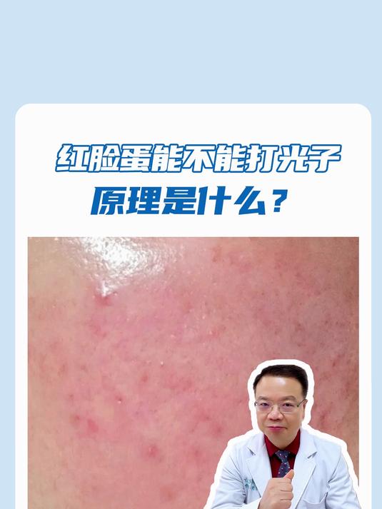 红脸蛋能不能打光子,为什么?
