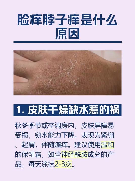 脸痒脖子痒是什么原因