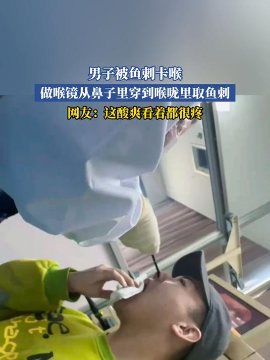 男子被鱼刺卡喉,做喉镜从鼻子里穿到喉咙里取鱼刺