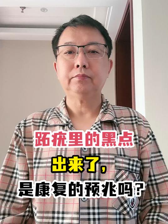 跖疣里的黑点出来了,是康复的预兆吗?