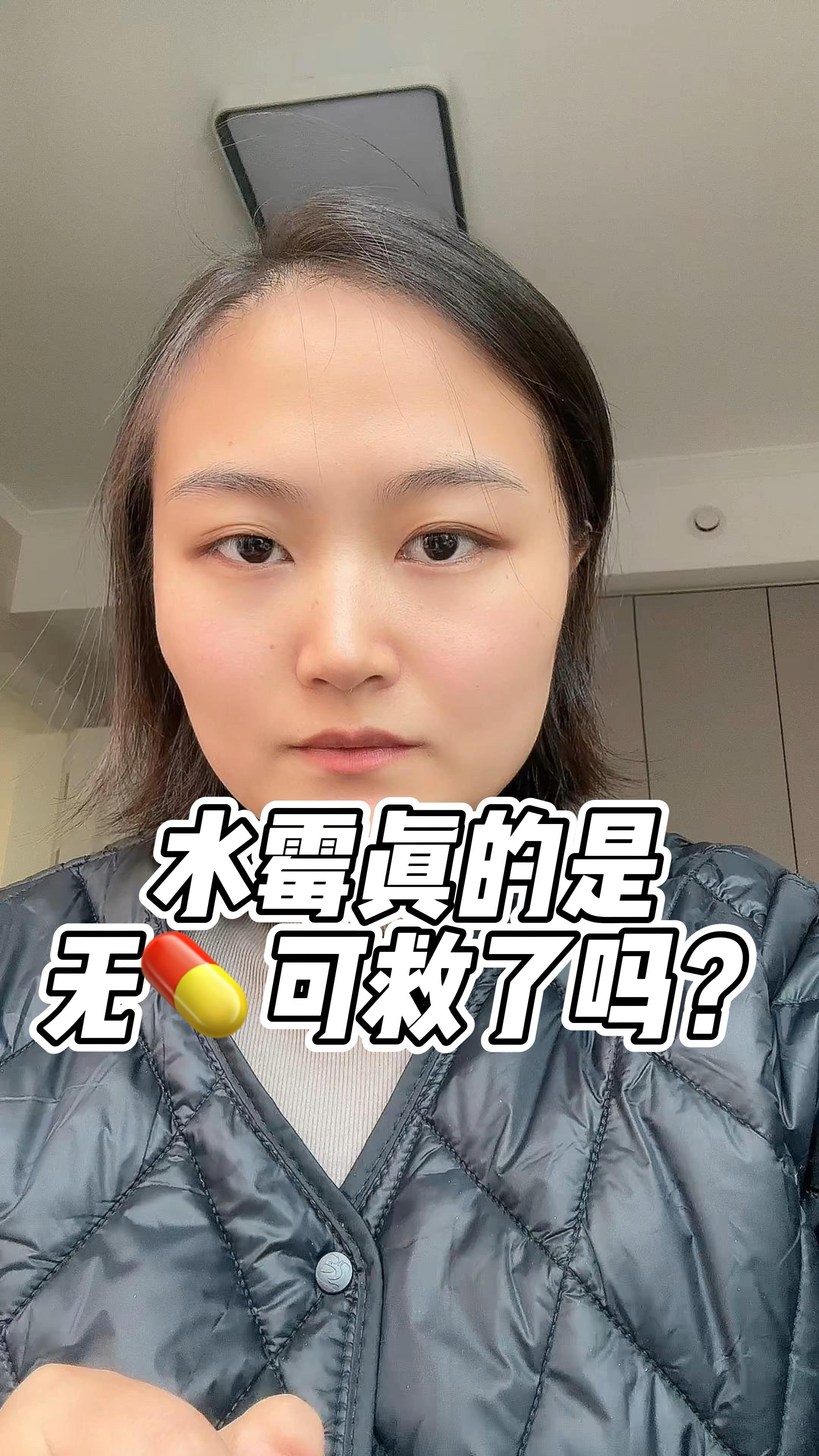 教你如何预防水霉病