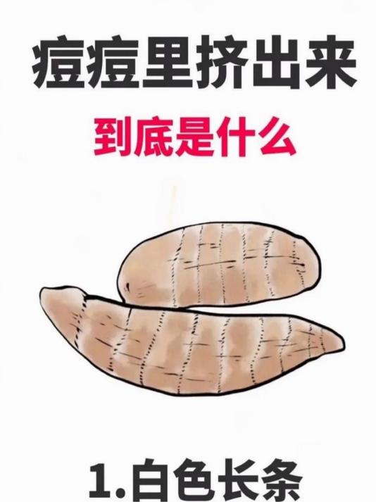 痘痘真相大揭秘:挤出来的不只是脓!