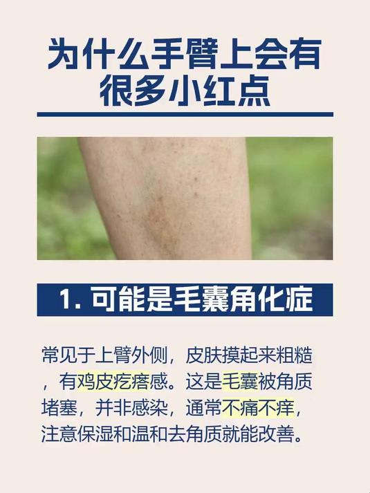 #马上健康过大年#为什么手臂上会有很多小红点