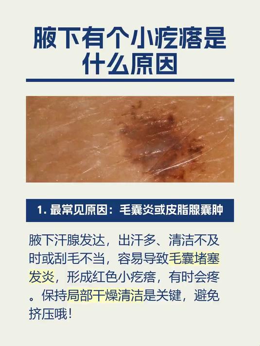 腋下有个小疙瘩是什么原因