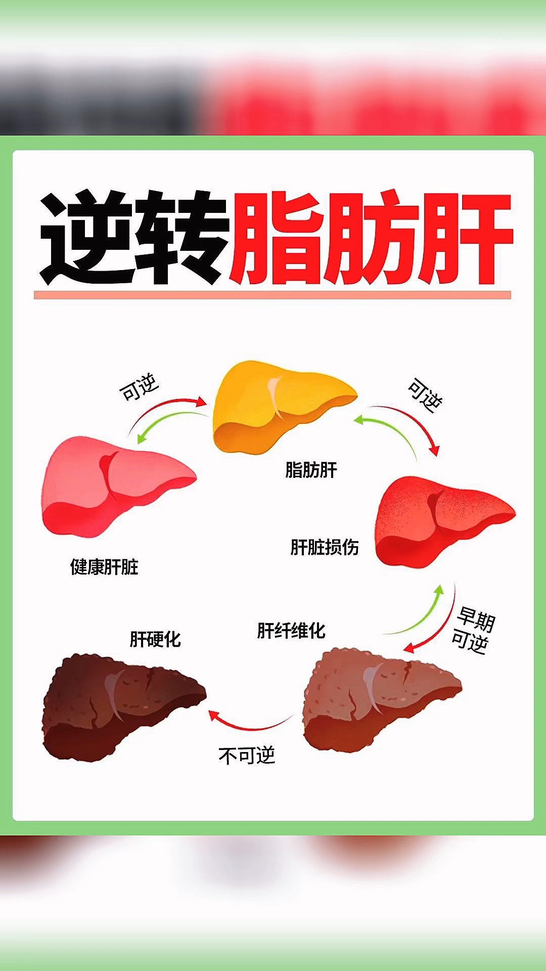 脂肪肝的症状表现
