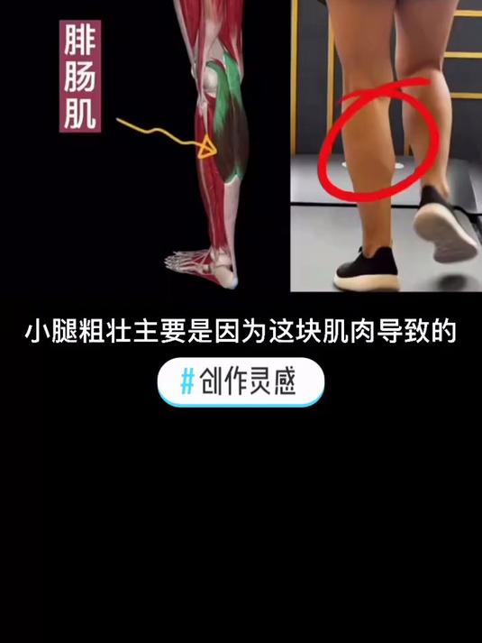 小腿粗壮怎么办？方法做对了，小腿自然就瘦了……#我要上热门#