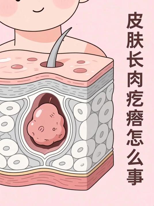 皮肤长肉疙瘩怎么回事 #健康扬帆季#