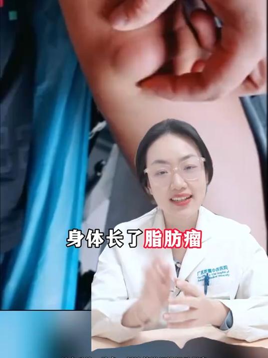 身体长了脂肪瘤 送你一个经典方