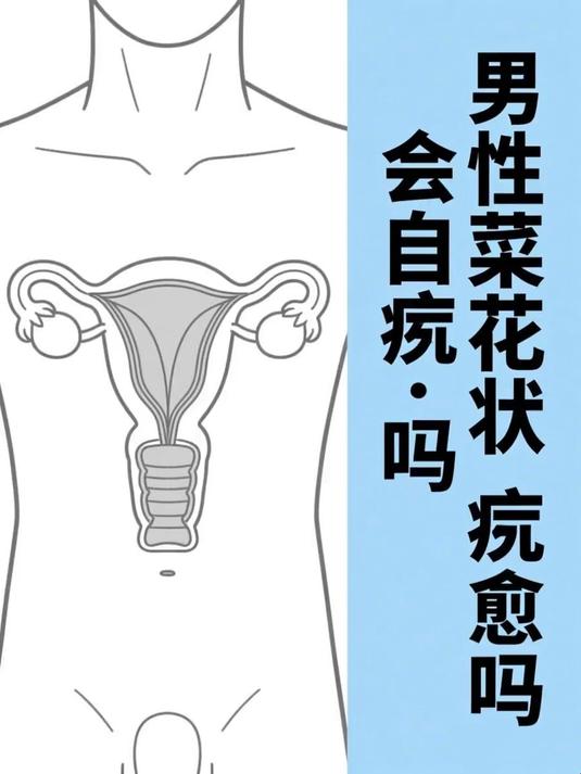 男性菜花状疣会自愈吗