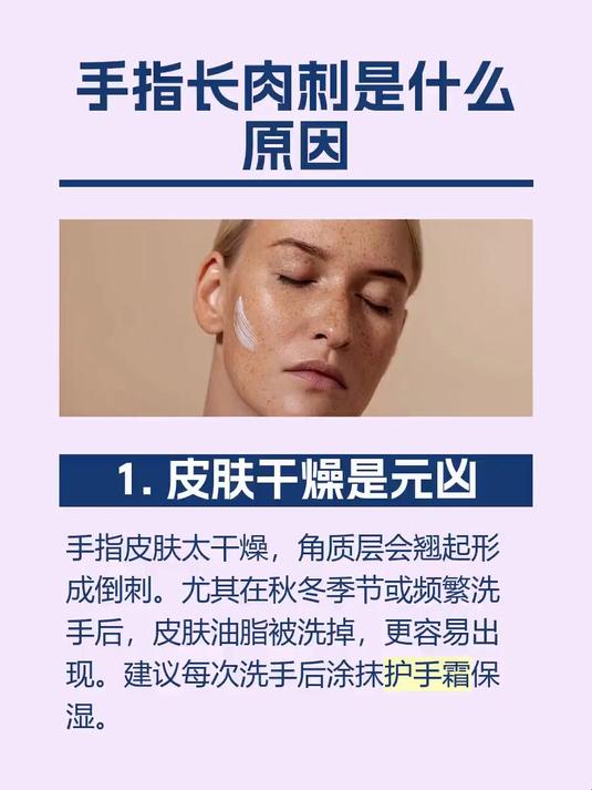 手指长肉刺是什么原因