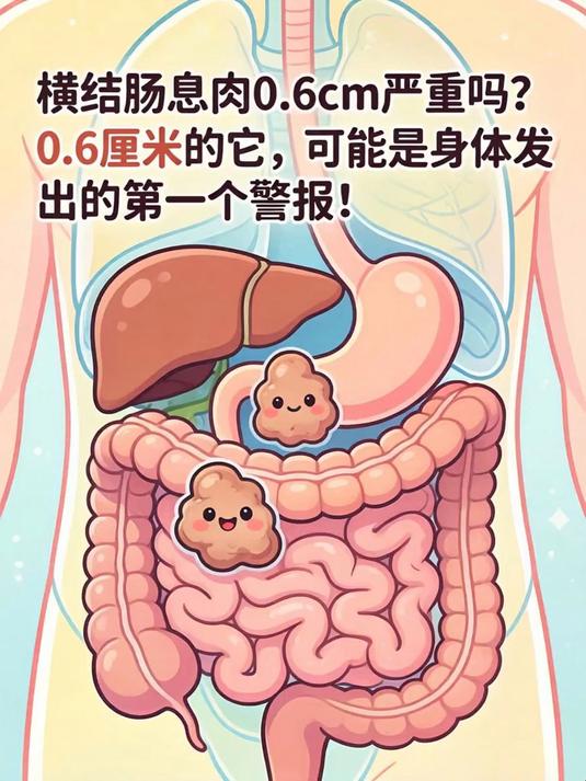 横结肠息肉0.6cm严重吗？0.6厘米的它，可能是身体发出的第一个警报！