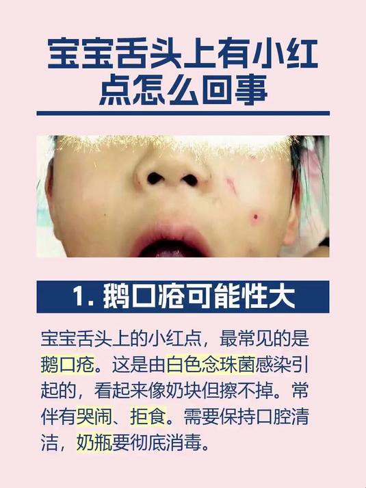 宝宝舌头上有小红点怎么回事