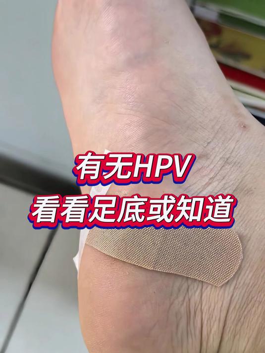 有无HPV,看看足底或知道